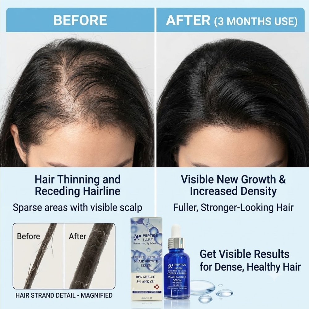 Essence de croissance des chev - Hyaluronic Acid Facial Serum avis et prix