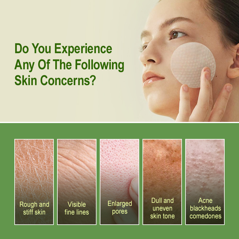 Coussinets exfoliants à l'acid - Salicylic Acid Blackhead Remover avis et prix