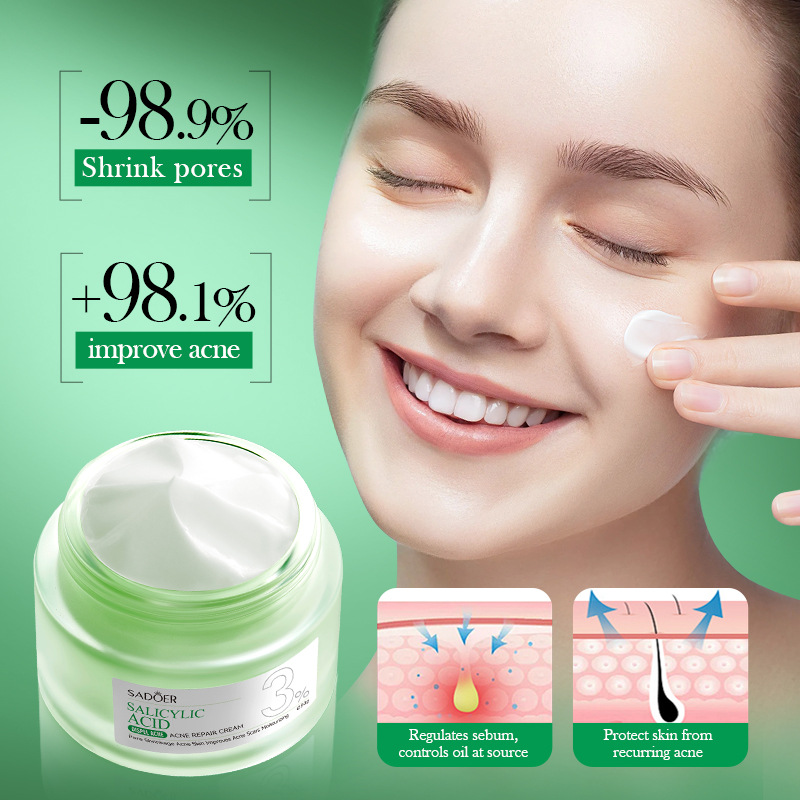 Crème de traitement de l'acné  - Salicylic Acid Blackhead Remover avis et prix