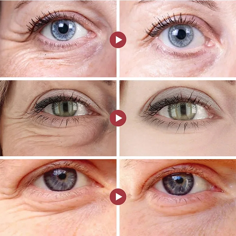 Patchs anti-rides pour les yeu - Collagen Under Eye Patches avis et prix