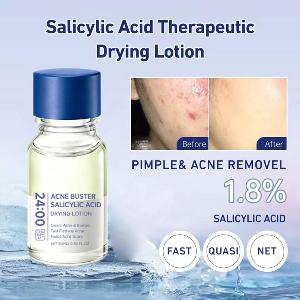 Acide Salicylique Anti-Acné, É - Salicylic Acid Blackhead Remover avis et prix